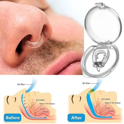 Say Goodbye to Snoring: Anti-Snore Nose Clip