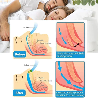 Say Goodbye to Snoring: Anti-Snore Nose Clip